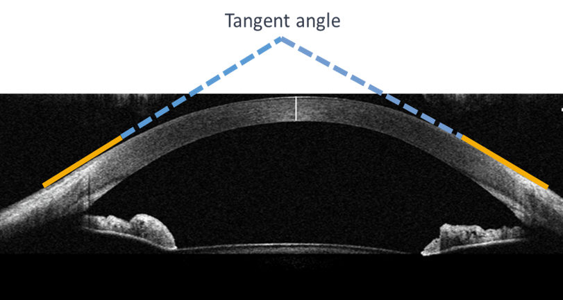 Menicon Z Night tangential