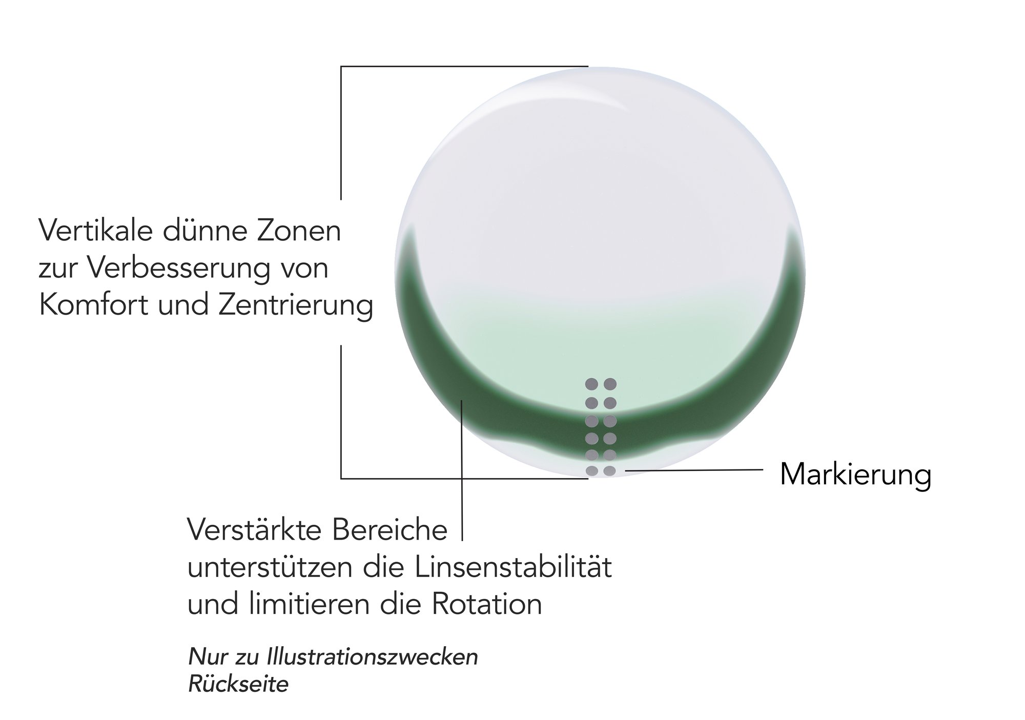 Flat Pack - Toric - All in one - Annotation_DE