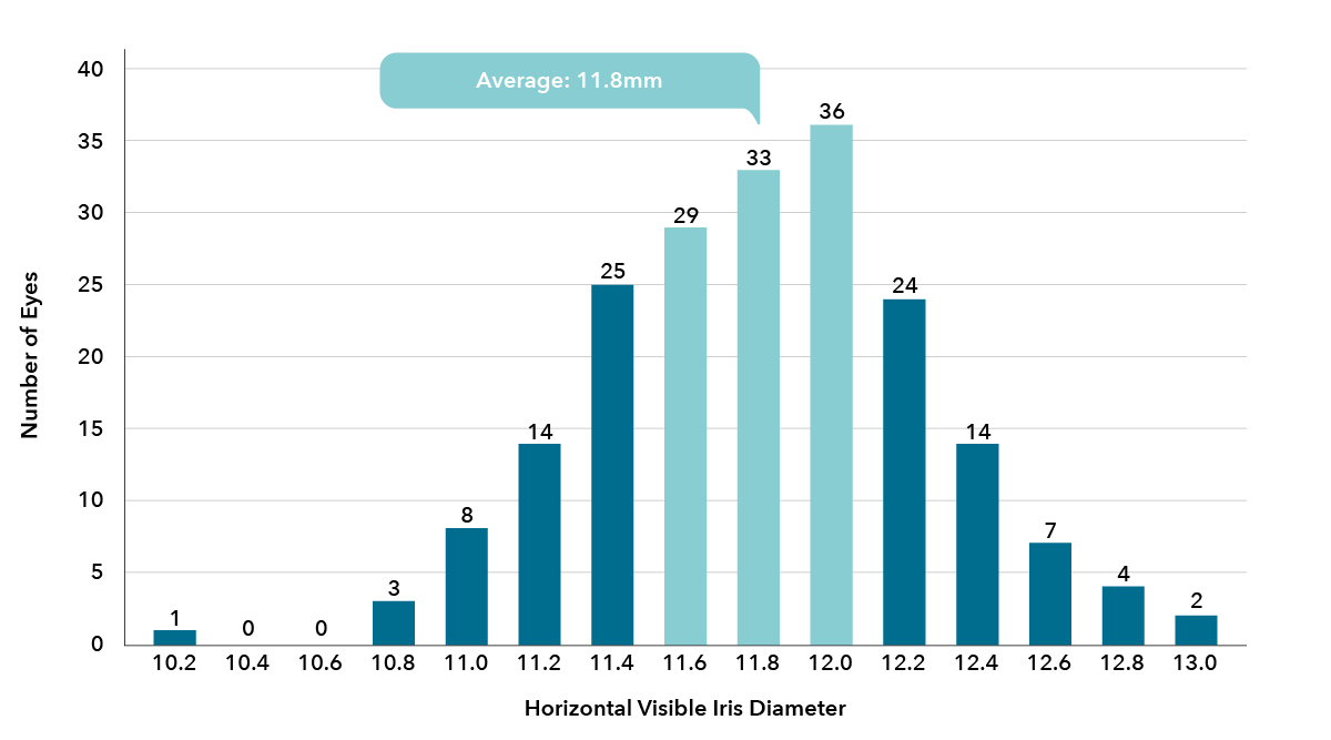 Grafik Irisdurchmesser