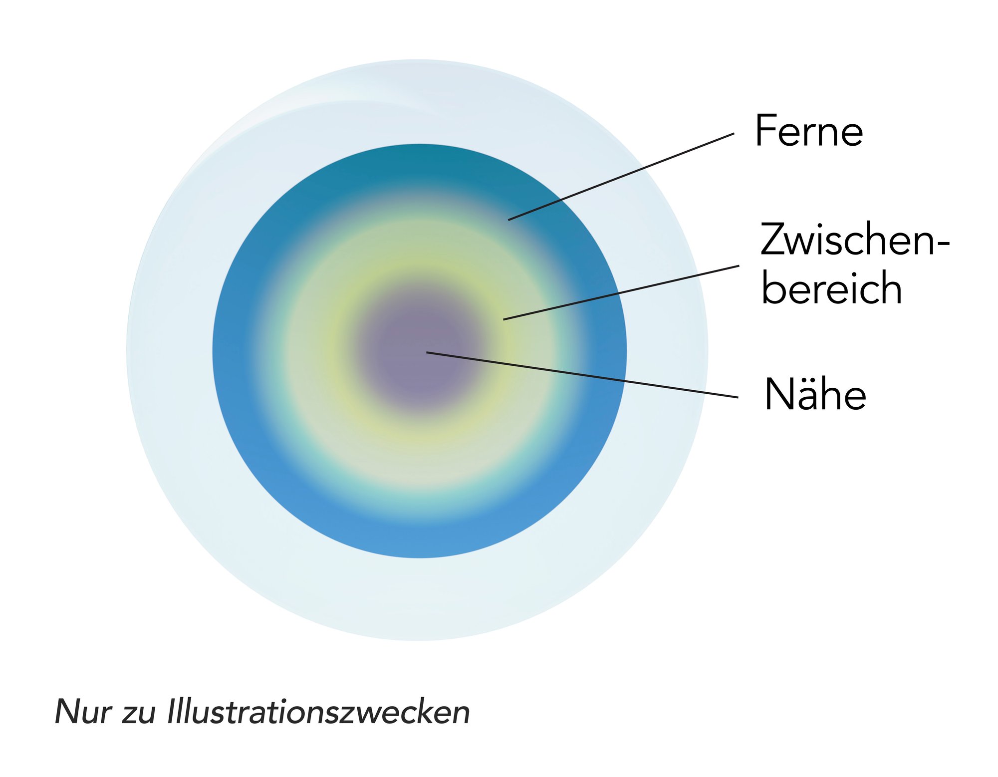 UpSide - Multifocal LOW - All in one - Annotation_DE