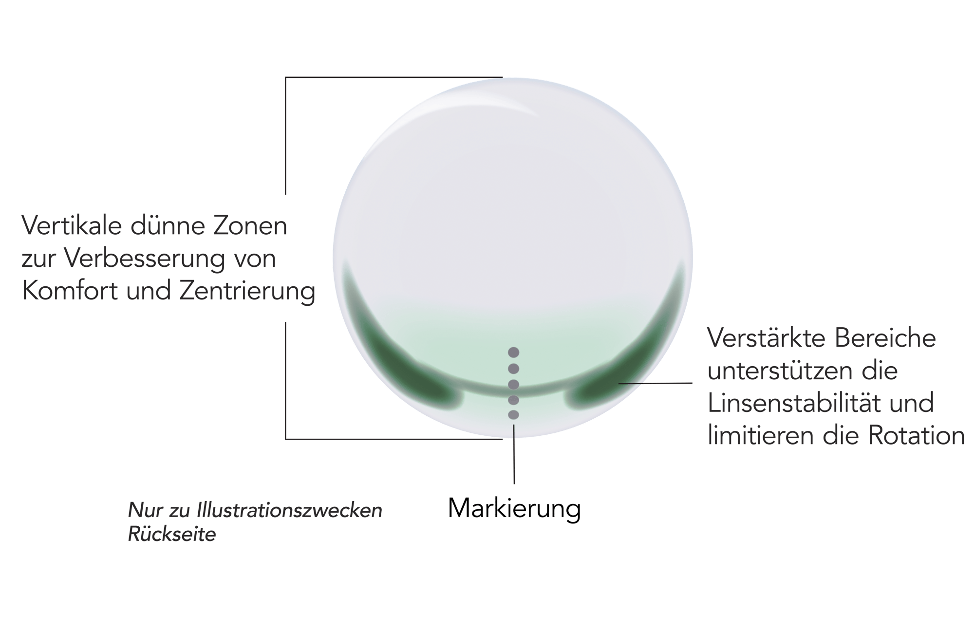 UpSide - Toric - All in One - Annotation_DE_02