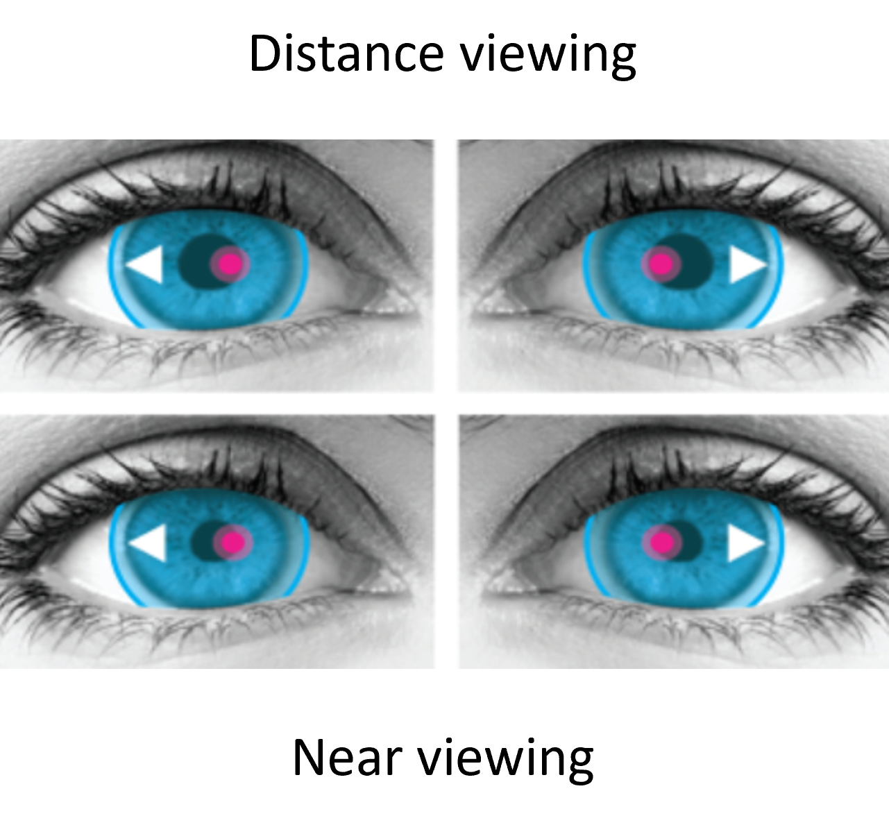 Miru 1month multifocal Sicht Grafik Miru 1month multifocal Sicht Grafik
